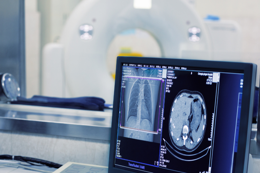 The Impact of Gantry Speed and Rotation Time on Workflow Efficiency